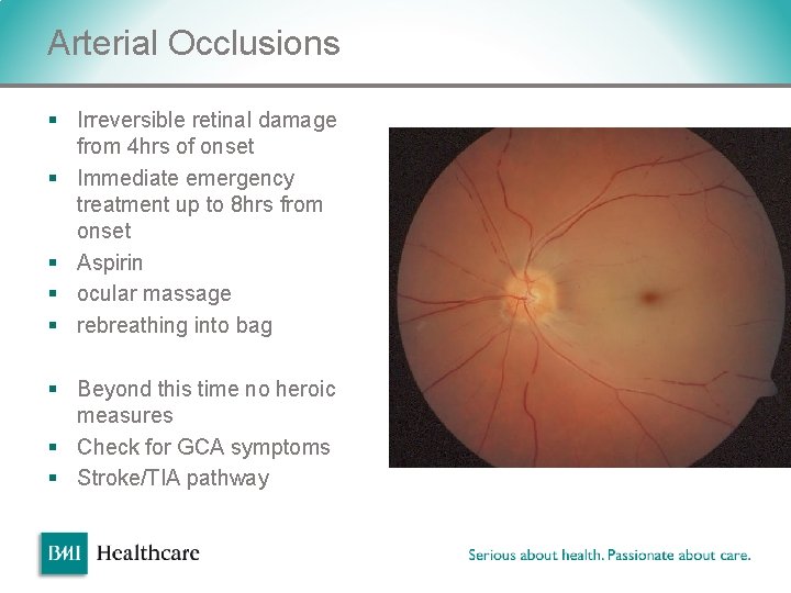 Arterial Occlusions § Irreversible retinal damage from 4 hrs of onset § Immediate emergency Arterial Occlusions § Irreversible retinal damage from 4 hrs of onset § Immediate emergency