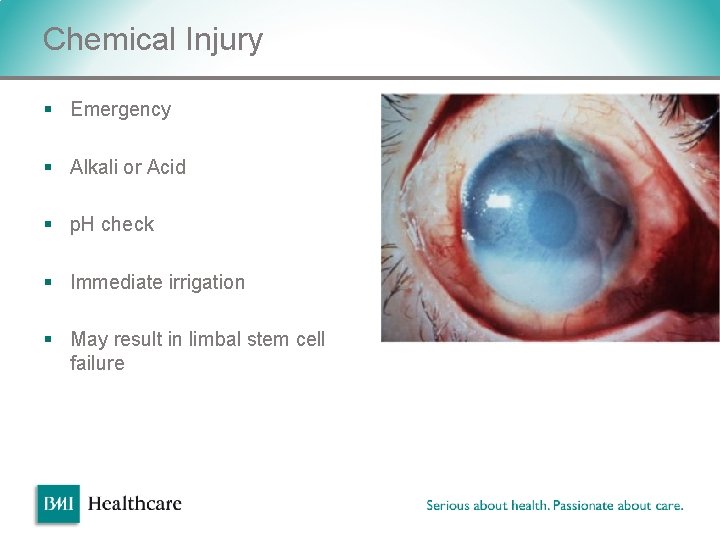 Chemical Injury § Emergency § Alkali or Acid § p. H check § Immediate Chemical Injury § Emergency § Alkali or Acid § p. H check § Immediate