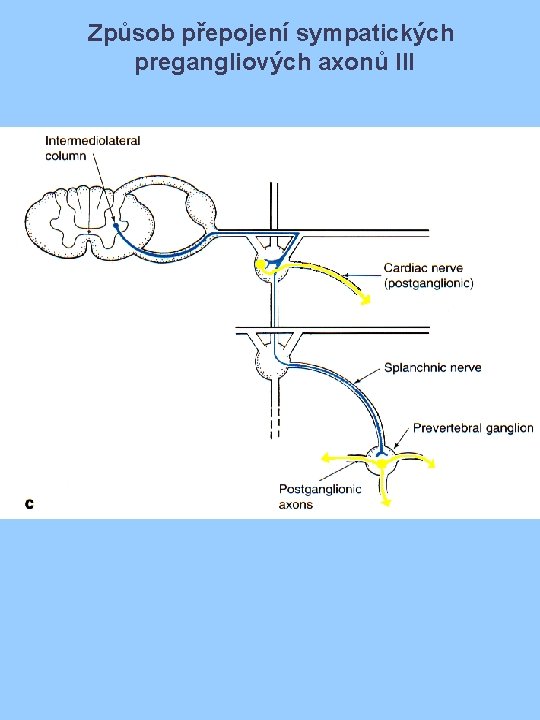 Způsob přepojení sympatických pregangliových axonů III 