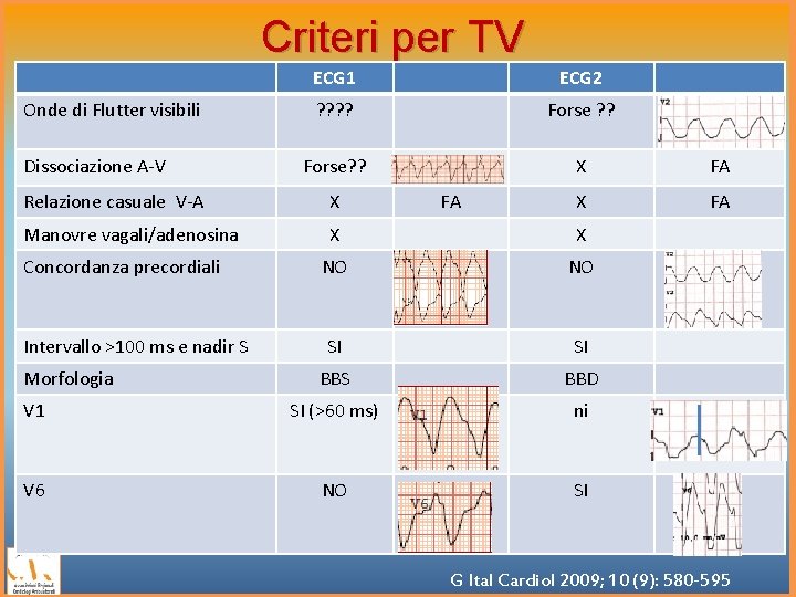 Criteri per TV Onde di Flutter visibili Dissociazione A-V ECG 1 ECG 2 ?