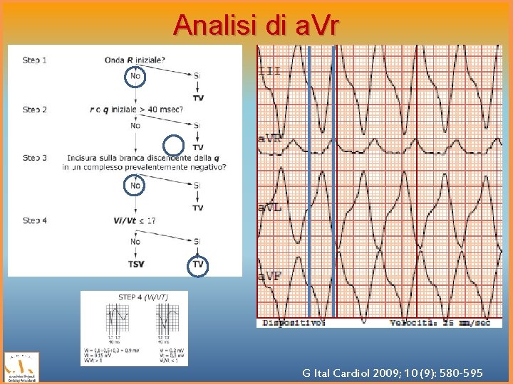 Analisi di a. Vr G Ital Cardiol 2009; 10 (9): 580 -595 