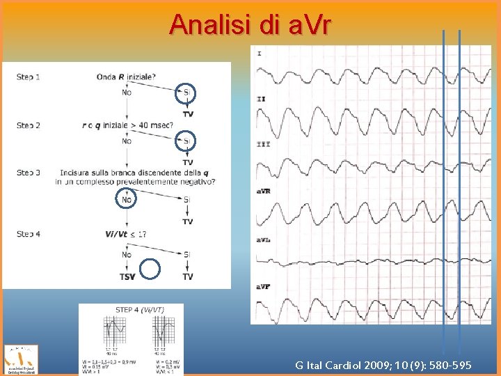 Analisi di a. Vr G Ital Cardiol 2009; 10 (9): 580 -595 