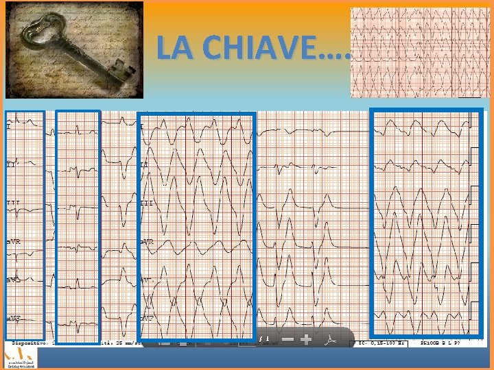 LA CHIAVE…. 