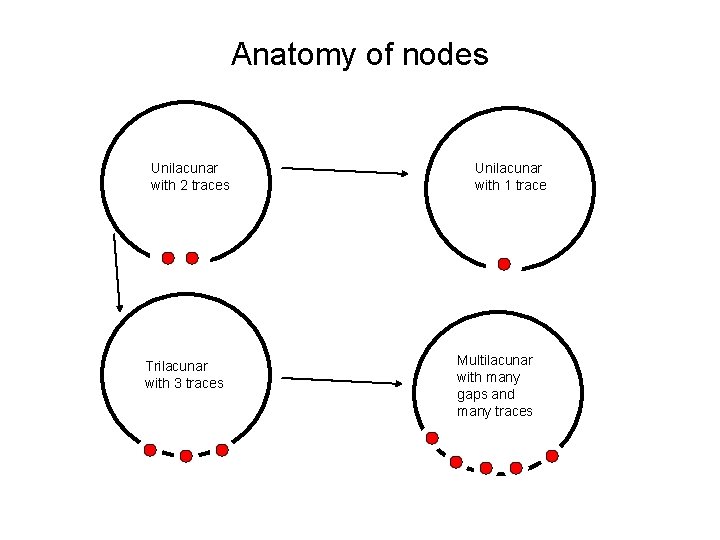 Anatomy of nodes Unilacunar with 2 traces Trilacunar with 3 traces Unilacunar with 1