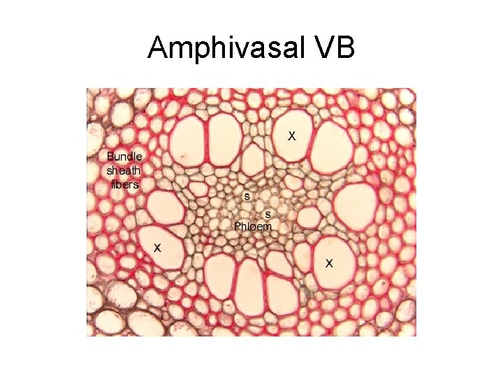 Amphivasal VB 