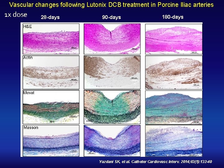 Vascular changes following Lutonix DCB treatment in Porcine Iliac arteries 1 x dose 28