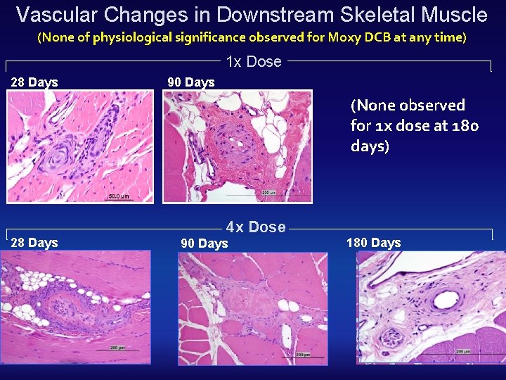 Vascular Changes in Downstream Skeletal Muscle (None of physiological significance observed for Moxy DCB