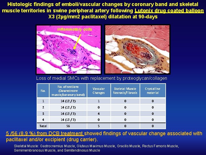 Histologic findings of emboli/vascular changes by coronary band skeletal muscle territories in swine peripheral