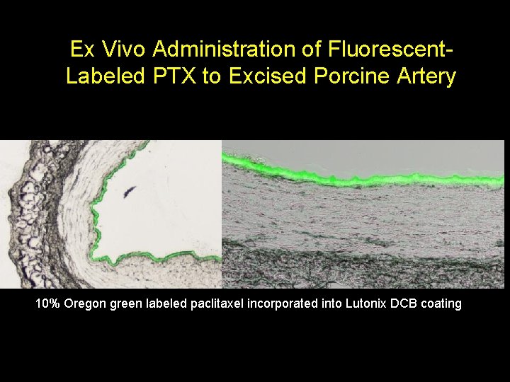 Ex Vivo Administration of Fluorescent. Labeled PTX to Excised Porcine Artery 10% Oregon green