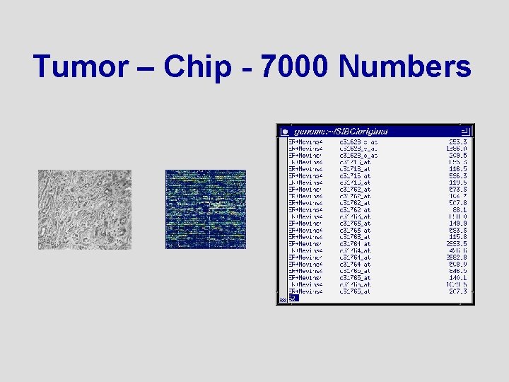 Tumor – Chip - 7000 Numbers 