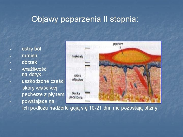 Objawy poparzenia II stopnia: • • ostry ból rumień obrzęk wrażliwość na dotyk uszkodzone