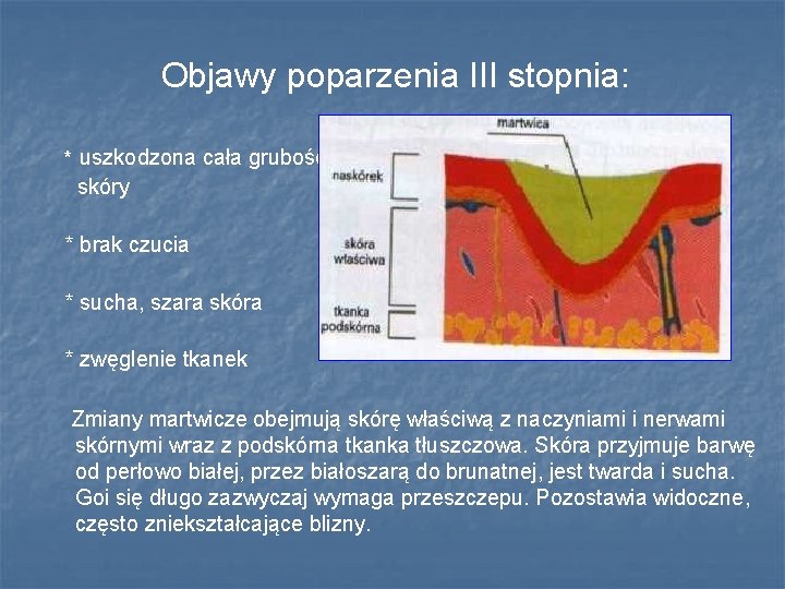 Objawy poparzenia III stopnia: * uszkodzona cała grubość skóry * brak czucia * sucha, Objawy poparzenia III stopnia: * uszkodzona cała grubość skóry * brak czucia * sucha,