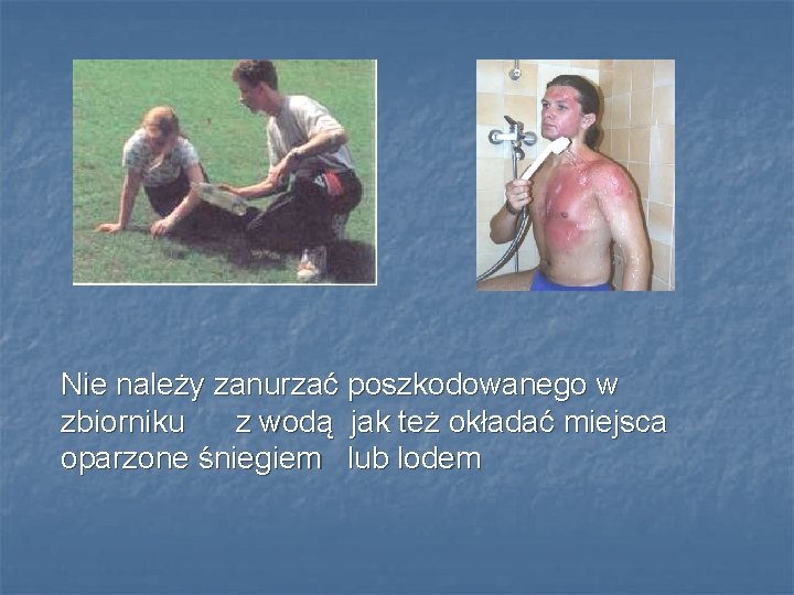 Nie należy zanurzać poszkodowanego w zbiorniku z wodą jak też okładać miejsca oparzone śniegiem Nie należy zanurzać poszkodowanego w zbiorniku z wodą jak też okładać miejsca oparzone śniegiem