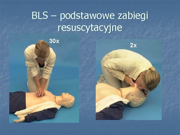 BLS – podstawowe zabiegi resuscytacyjne 30 x 2 x 