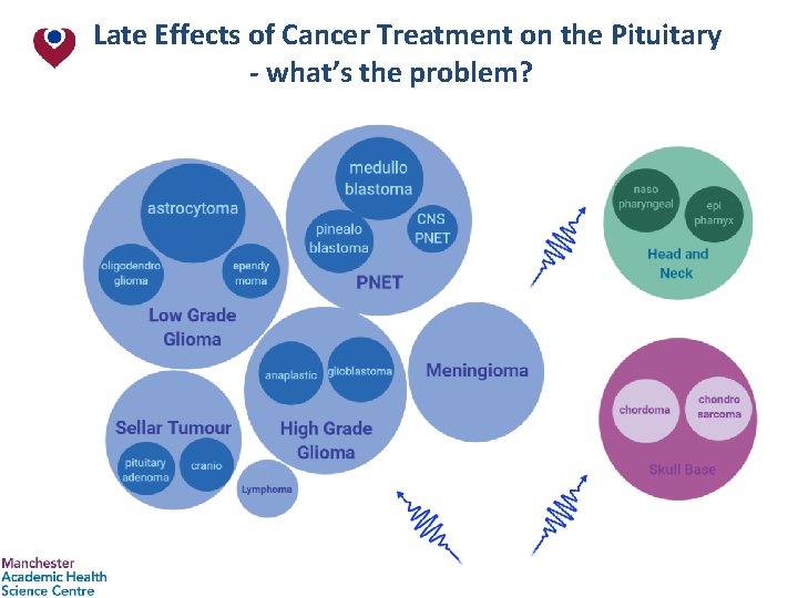 Late Effects of Cancer Treatment on the Pituitary - what’s the problem? 