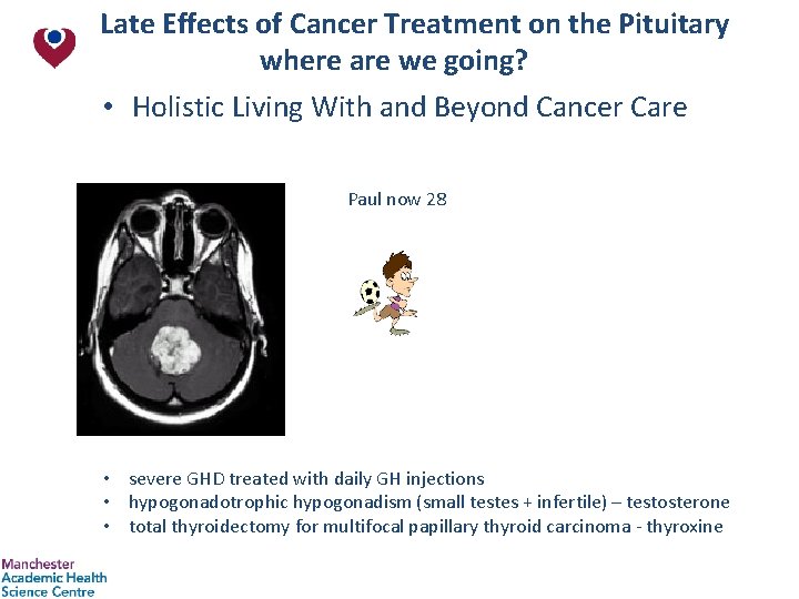 Late Effects of Cancer Treatment on the Pituitary where are we going? • Holistic