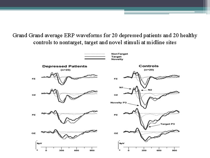 Grand average ERP waveforms for 20 depressed patients and 20 healthy controls to nontarget,
