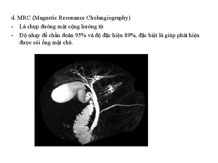 d. MRC (Magnetic Resonance Cholangiography) - Là chụp đường mật cộng hưởng từ -