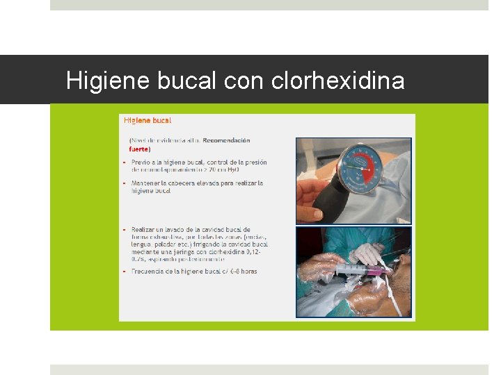Higiene bucal con clorhexidina 