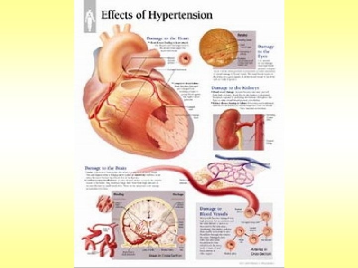 hipertenzijom i promjenama u miokardu