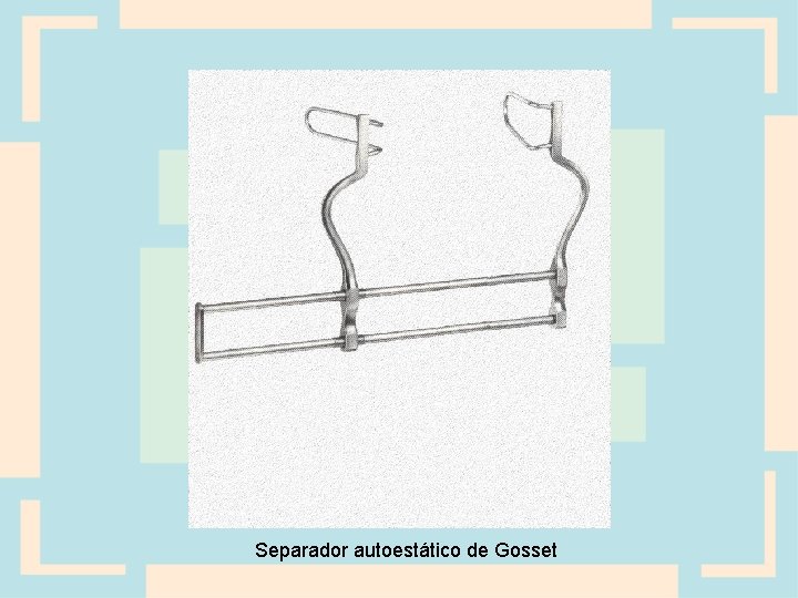 Separador autoestático de Gosset 