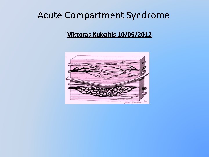Acute Compartment Syndrome Viktoras Kubaitis 10/09/2012 