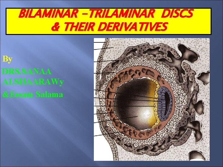 BILAMINAR -TRILAMINAR DISCS & THEIR DERIVATIVES By DRS. SANAA ALSHAARAWy &Essam Salama 