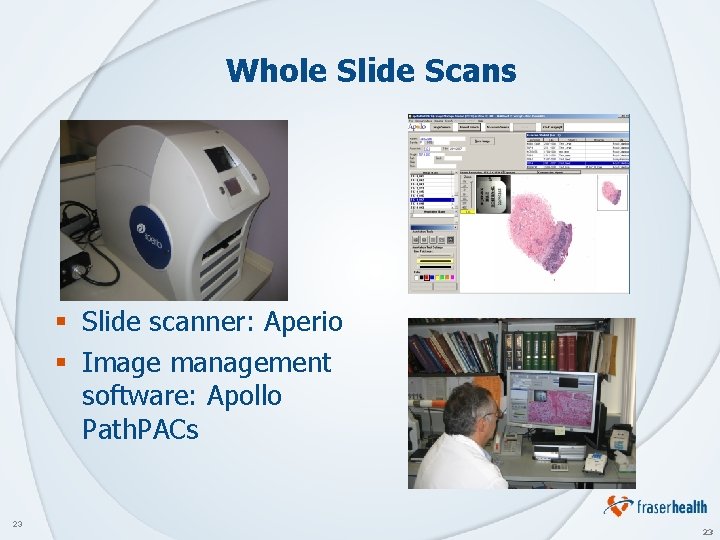Whole Slide Scans § Slide scanner: Aperio § Image management software: Apollo Path. PACs