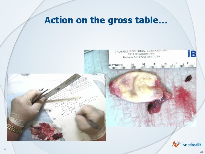 Action on the gross table… 25 25 