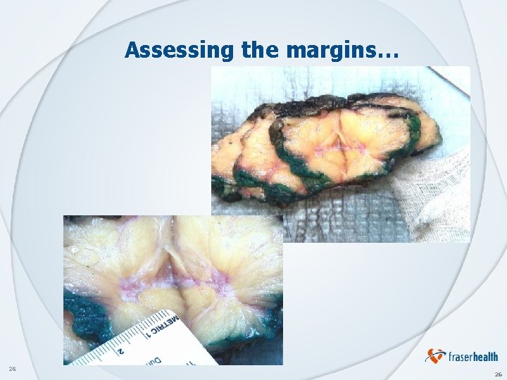 Assessing the margins… 26 26 