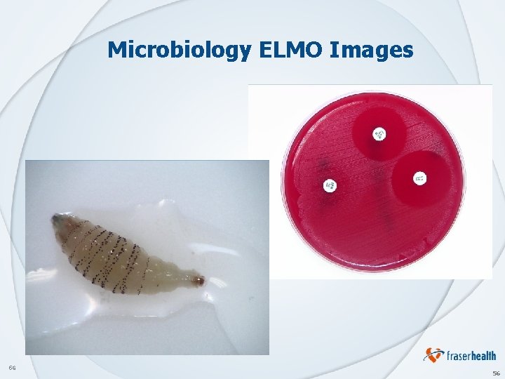 Microbiology ELMO Images 56 56 