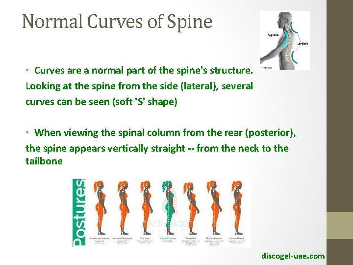 Normal Curves of Spine • Curves are a normal part of the spine's structure.