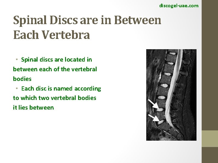 discogel-uae. com Spinal Discs are in Between Each Vertebra • Spinal discs are located