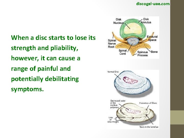 discogel-uae. com When a disc starts to lose its strength and pliability, however, it