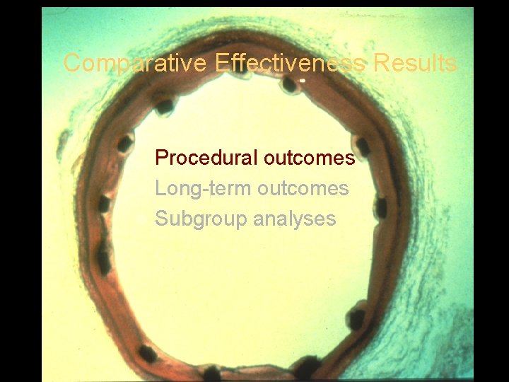 Comparative Effectiveness Results Procedural outcomes l Long-term outcomes l Subgroup analyses l 