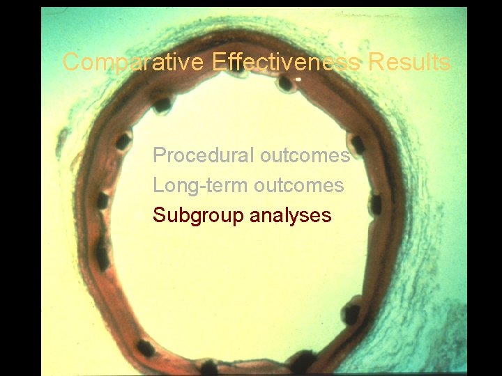 Comparative Effectiveness Results Procedural outcomes l Long-term outcomes l Subgroup analyses l 