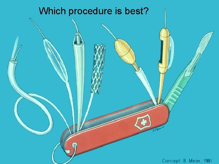 Which procedure is best? 
