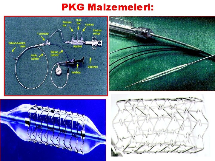 PKG Malzemeleri: 