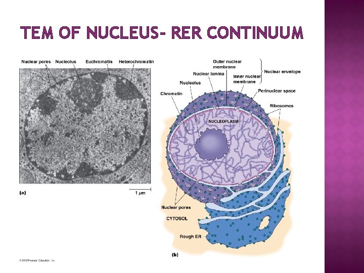 TEM OF NUCLEUS- RER CONTINUUM 