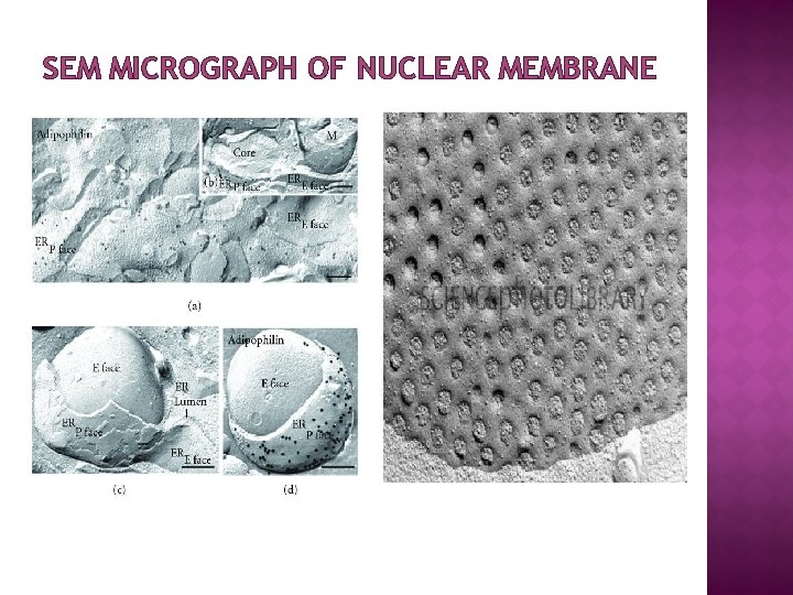 SEM MICROGRAPH OF NUCLEAR MEMBRANE 