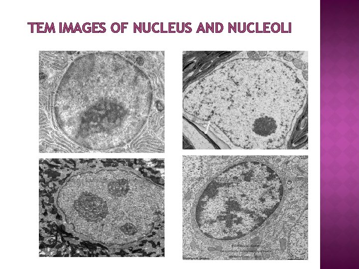 TEM IMAGES OF NUCLEUS AND NUCLEOLI 