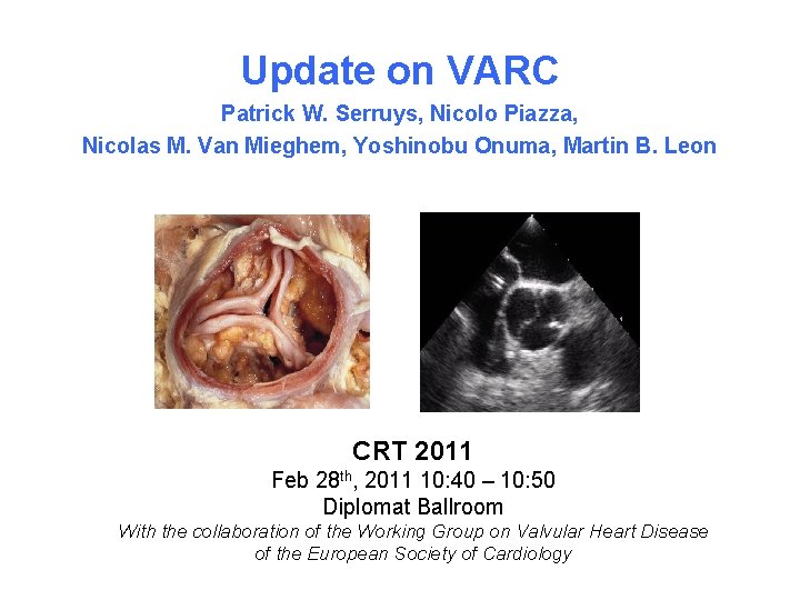 Update on VARC Patrick W. Serruys, Nicolo Piazza, Nicolas M. Van Mieghem, Yoshinobu Onuma, Update on VARC Patrick W. Serruys, Nicolo Piazza, Nicolas M. Van Mieghem, Yoshinobu Onuma,