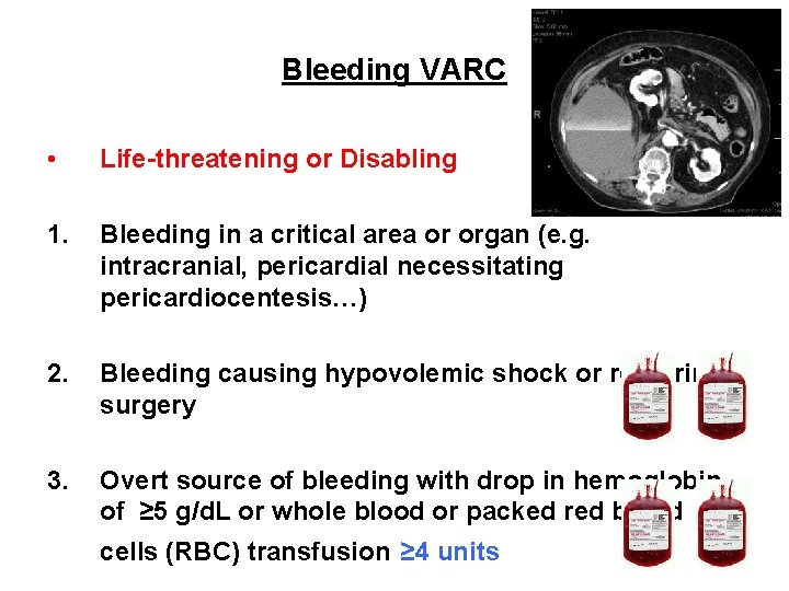Bleeding VARC • Life-threatening or Disabling 1. Bleeding in a critical area or organ Bleeding VARC • Life-threatening or Disabling 1. Bleeding in a critical area or organ