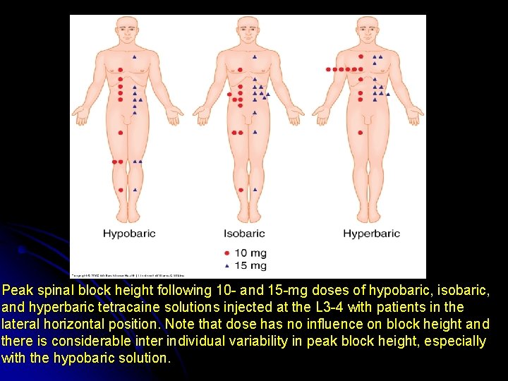 Peak spinal block height following 10 - and 15 -mg doses of hypobaric, isobaric,