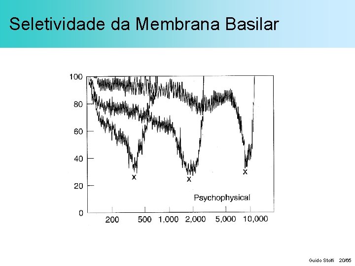 Seletividade da Membrana Basilar Guido Stolfi 20/65 