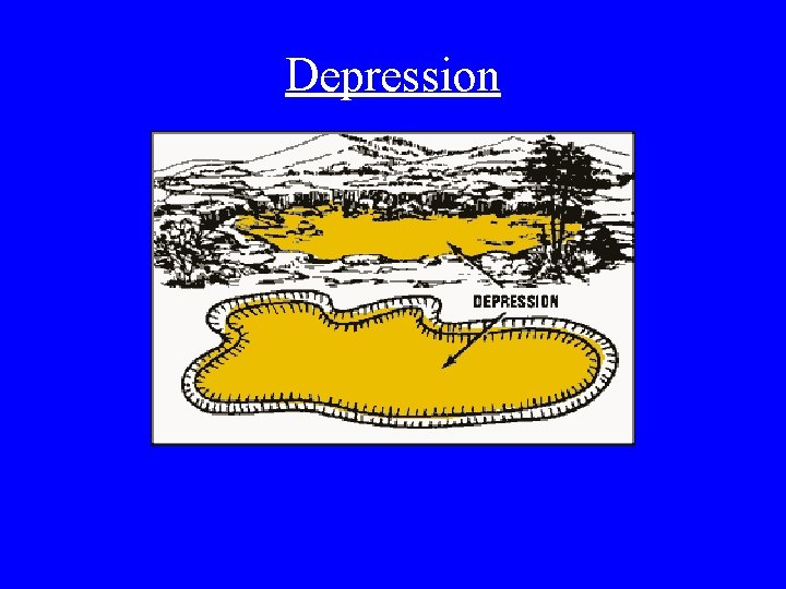 Depression 