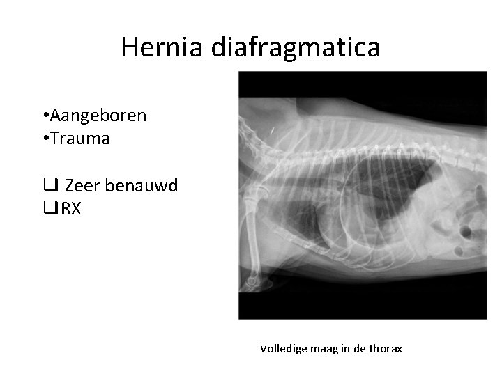 Hernia diafragmatica • Aangeboren • Trauma q Zeer benauwd q. RX Volledige maag in