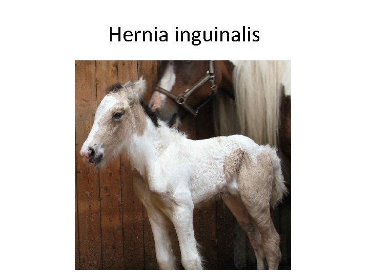 Hernia inguinalis 