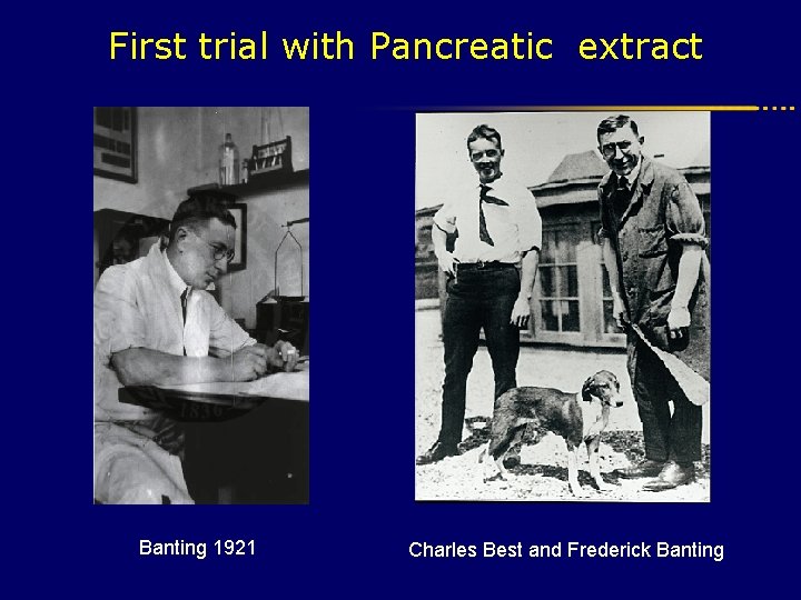 First trial with Pancreatic extract Banting 1921 Charles Best and Frederick Banting 