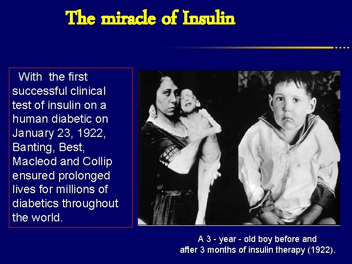 The miracle of Insulin With the first successful clinical test of insulin on a